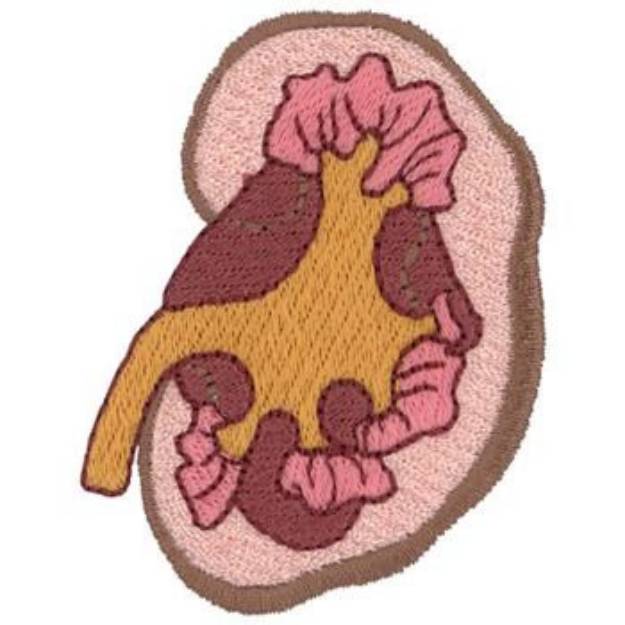 Picture of Kidney Machine Embroidery Design