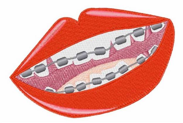 Picture of Braces Teeth Machine Embroidery Design